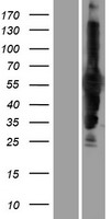 CARD9 Human Over-expression Lysate