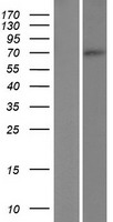 ABLIM2 Human Over-expression Lysate