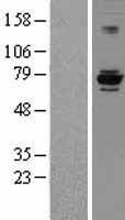 EEF1D Human Over-expression Lysate