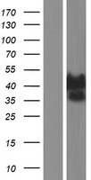 Ataxin 3 (ATXN3) Human Over-expression Lysate
