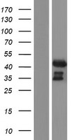ADA Human Over-expression Lysate