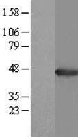 AGXT Human Over-expression Lysate