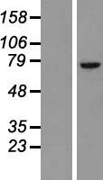 BTK Human Over-expression Lysate
