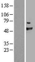 FANCC Human Over-expression Lysate