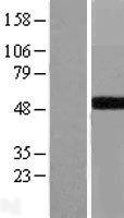 GALT Human Over-expression Lysate