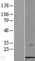 PCBD1 Human Over-expression Lysate