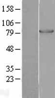 PFKM Human Over-expression Lysate