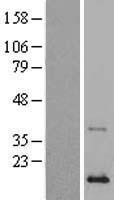 Phospholipase A2 IIA (PLA2G2A) Human Over-expression Lysate