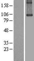 TGM1 Human Over-expression Lysate