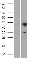 WASP (WAS) Human Over-expression Lysate