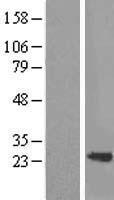 SM22 alpha (TAGLN) Human Over-expression Lysate