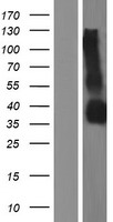 GPM6B Human Over-expression Lysate