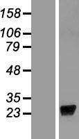 LCN9 Human Over-expression Lysate