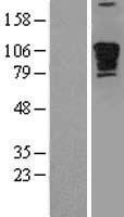 PDE4DIP Human Over-expression Lysate