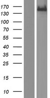 KDM2B Human Over-expression Lysate