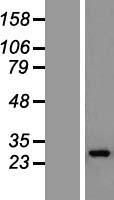 GOSR1 Human Over-expression Lysate