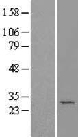 MTX2 Human Over-expression Lysate