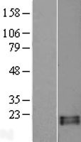 RNASE13 Human Over-expression Lysate