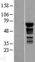 PAK4 Human Over-expression Lysate