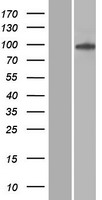 CARS1 Human Over-expression Lysate