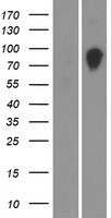OS9 Human Over-expression Lysate