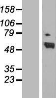 Retinoic Acid Receptor alpha (RARA) Human Over-expression Lysate