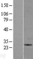 SLC35A2 Human Over-expression Lysate