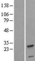 CPLX3 Human Over-expression Lysate