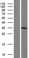 RING finger protein unkempt like (UNKL) Human Over-expression Lysate