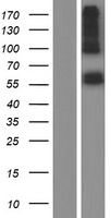 ALAS2 Human Over-expression Lysate