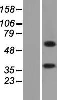 ALAS2 Human Over-expression Lysate