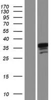 PPA2 Human Over-expression Lysate