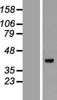 DEDD Human Over-expression Lysate
