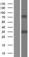 PHF11 Human Over-expression Lysate