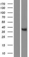 Lunatic Fringe (LFNG) Human Over-expression Lysate