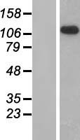 GPR64 (ADGRG2) Human Over-expression Lysate