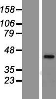 Constitutive androstane receptor (NR1I3) Human Over-expression Lysate