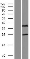 FAM166B Human Over-expression Lysate