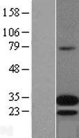 Adrenomedullin (ADM) Human Over-expression Lysate