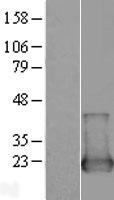 NUDT2 Human Over-expression Lysate