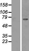 CAMK2B Human Over-expression Lysate