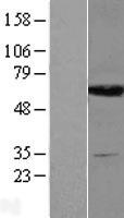 Dihydropyrimidinase (DPYS) Human Over-expression Lysate