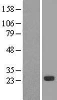 Cysteine Dioxygenase Type 1 (CDO1) Human Over-expression Lysate