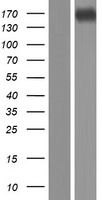 CPS1 Human Over-expression Lysate