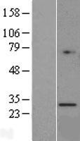 Granzyme K (GZMK) Human Over-expression Lysate
