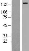 LRP6 Human Over-expression Lysate