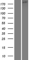 TRPM1 Human Over-expression Lysate