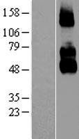 p75 NGF Receptor (NGFR) Human Over-expression Lysate