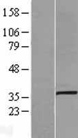 SLC25A3 Human Over-expression Lysate