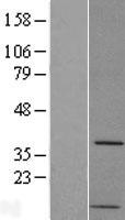 PP2A-alpha (PPP2CA) Human Over-expression Lysate
